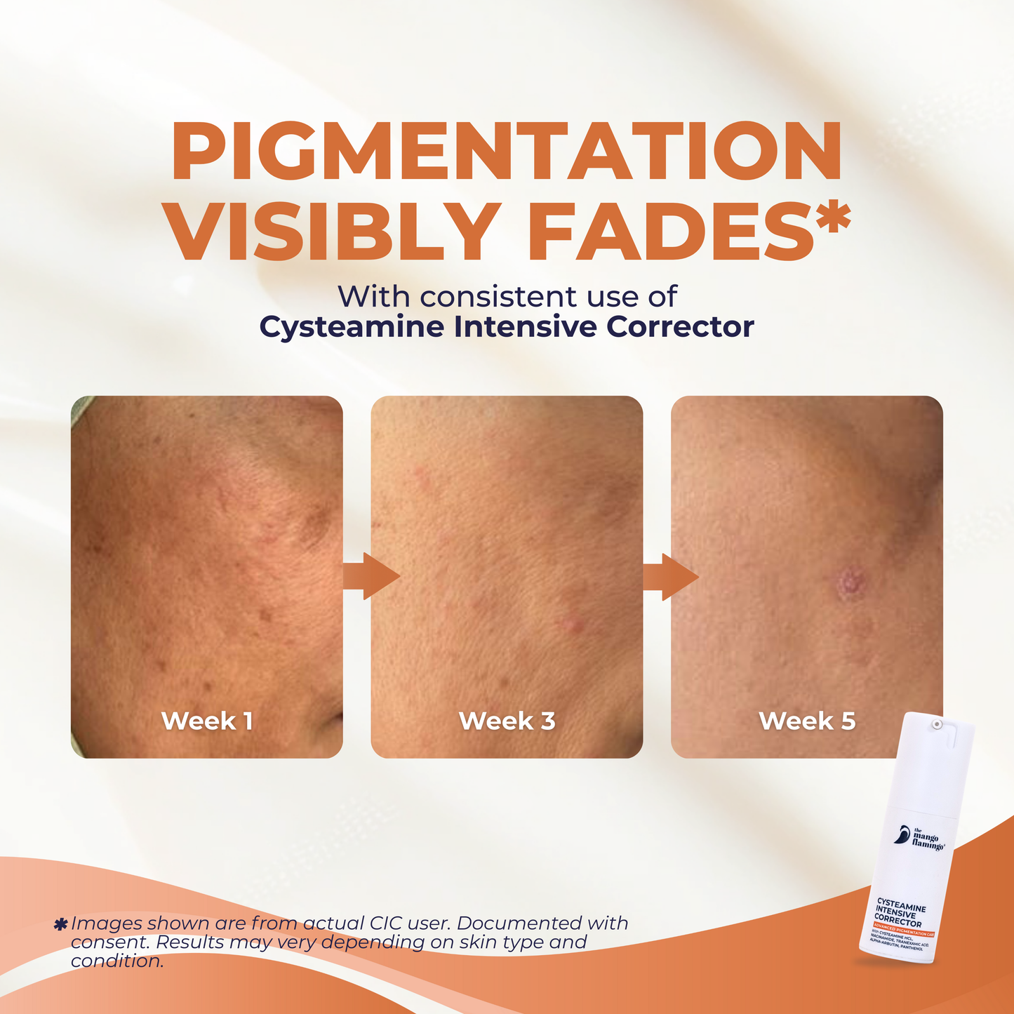 Cysteamine Intensive Corrector 30ml Advanced Dark Spot & Melasma Treatment